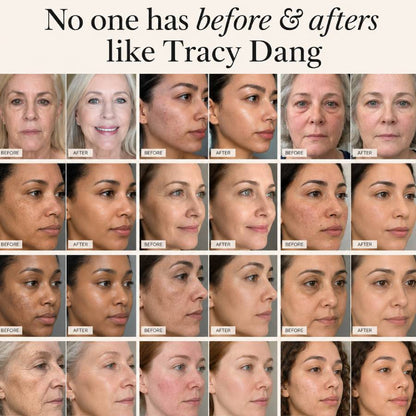 The Skin Reset System™