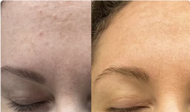 Nicole, 39